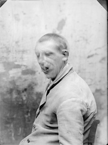 17 Patiënt. Man., 1907-06-01
